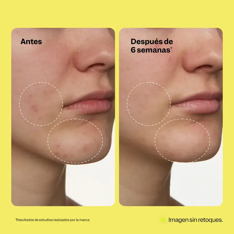 Super Fade - Sérum Corrector de Manchas, con ácido tranexámico y niacinamida - 30 ml