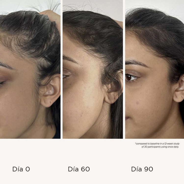 Scalp Care - Sérum de Densidad Capilar, resultados clínicos en 90 días - 50 ml