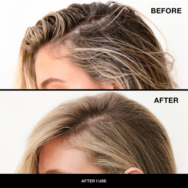 First Class Charcoal Detox Dry Shampoo en seco limpia al instante